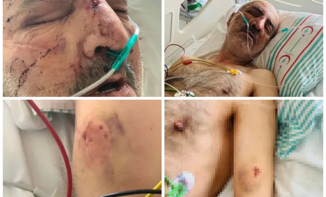 Elâzığ'da bakım merkezinde engelli vatandaş darp edildi